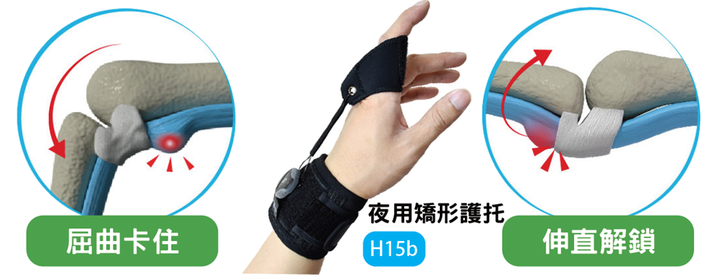 Trigger finger conservative treatment